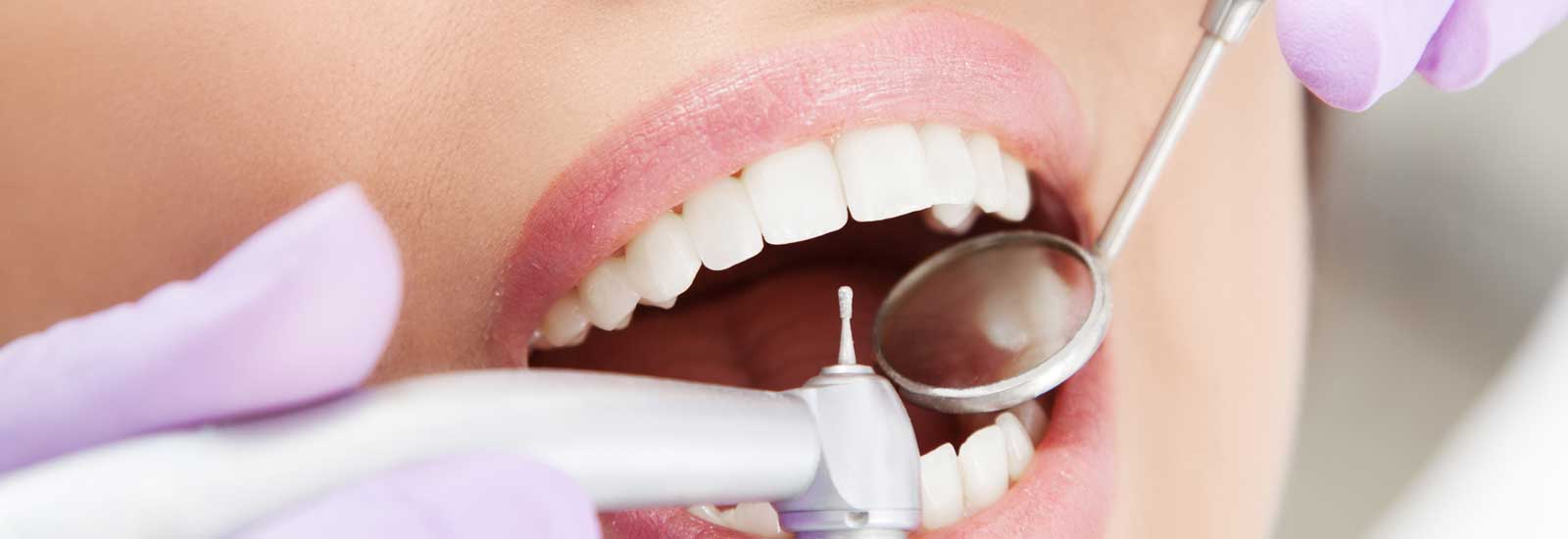 Replace missing teeth with dental implants