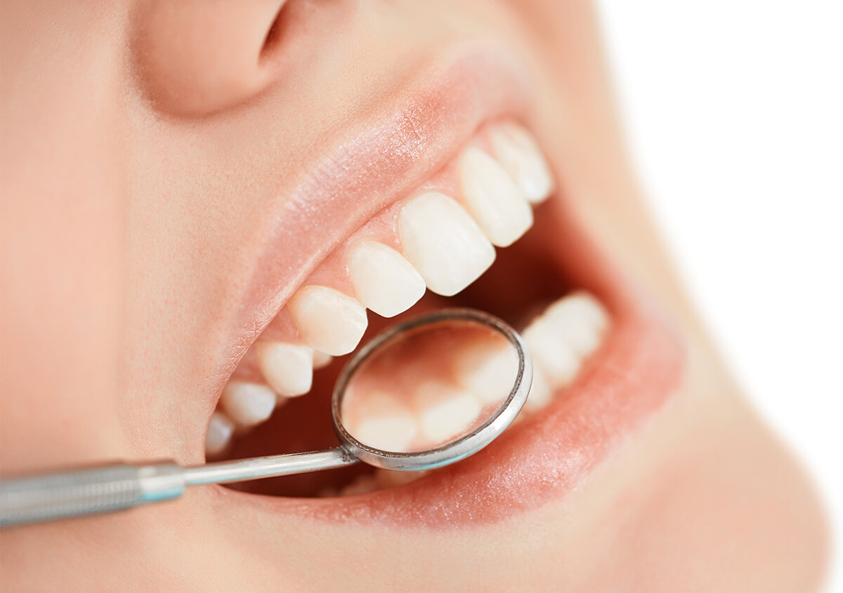 Are Tooth-Colored Fillings Better than Silver Amalgam Fillings for Cavities?
