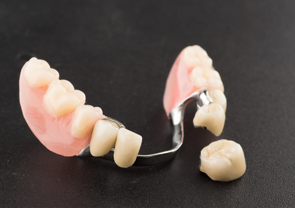 Complete Vs. Partial Dentures: Benefits and Differences